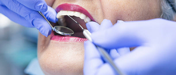 Best Emergency Dental Care for Sports Injuries in Temperance, MI